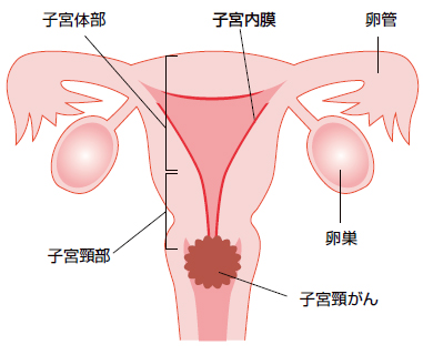 子 宮頸 が ん が 消え た 食べ物