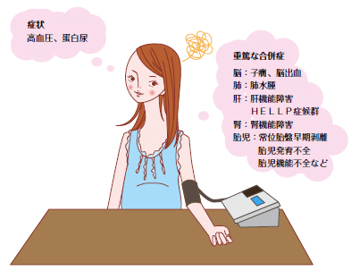 妊娠高血圧症候群イメージ